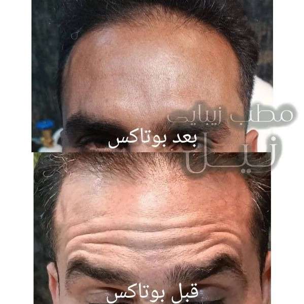 مطب زیبایی نیل