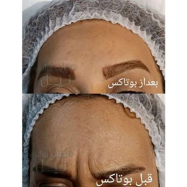 مطب زیبایی نیل