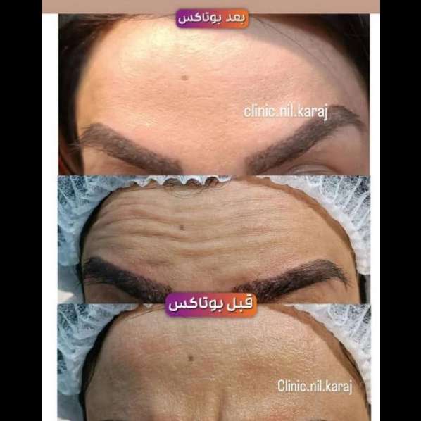 مطب زیبایی نیل