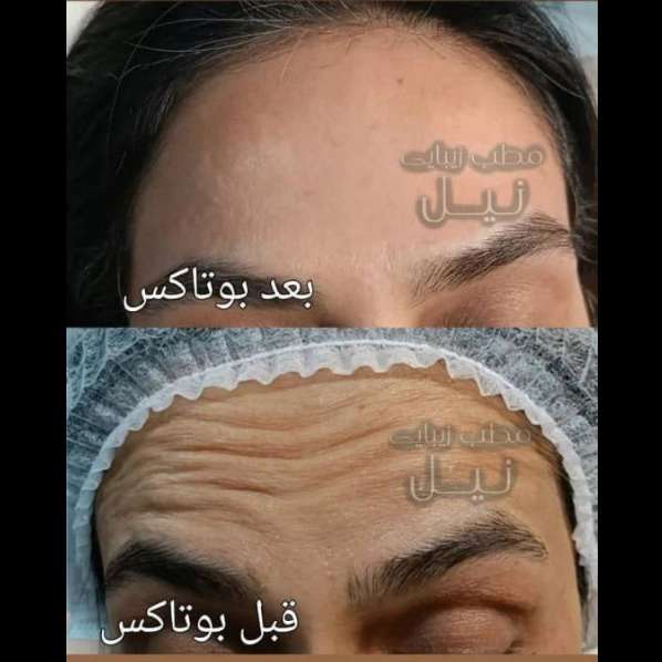 مطب زیبایی نیل