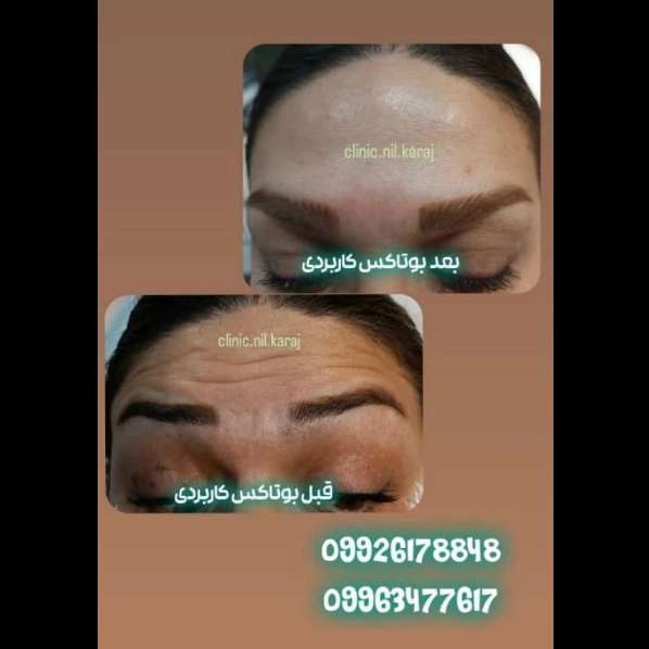 مطب زیبایی نیل