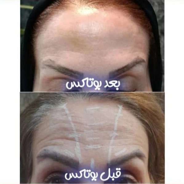 مطب زیبایی نیل