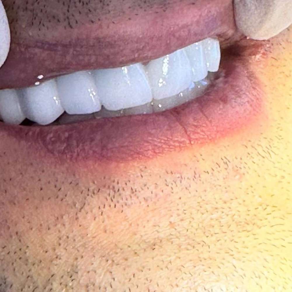 لابراتوار تخصصی پروتز دندان و ایمپلنت علیرضا جمالی