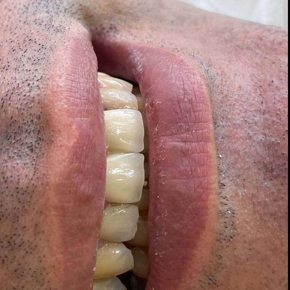 لابراتوار تخصصی پروتز دندان و ایمپلنت علیرضا جمالی