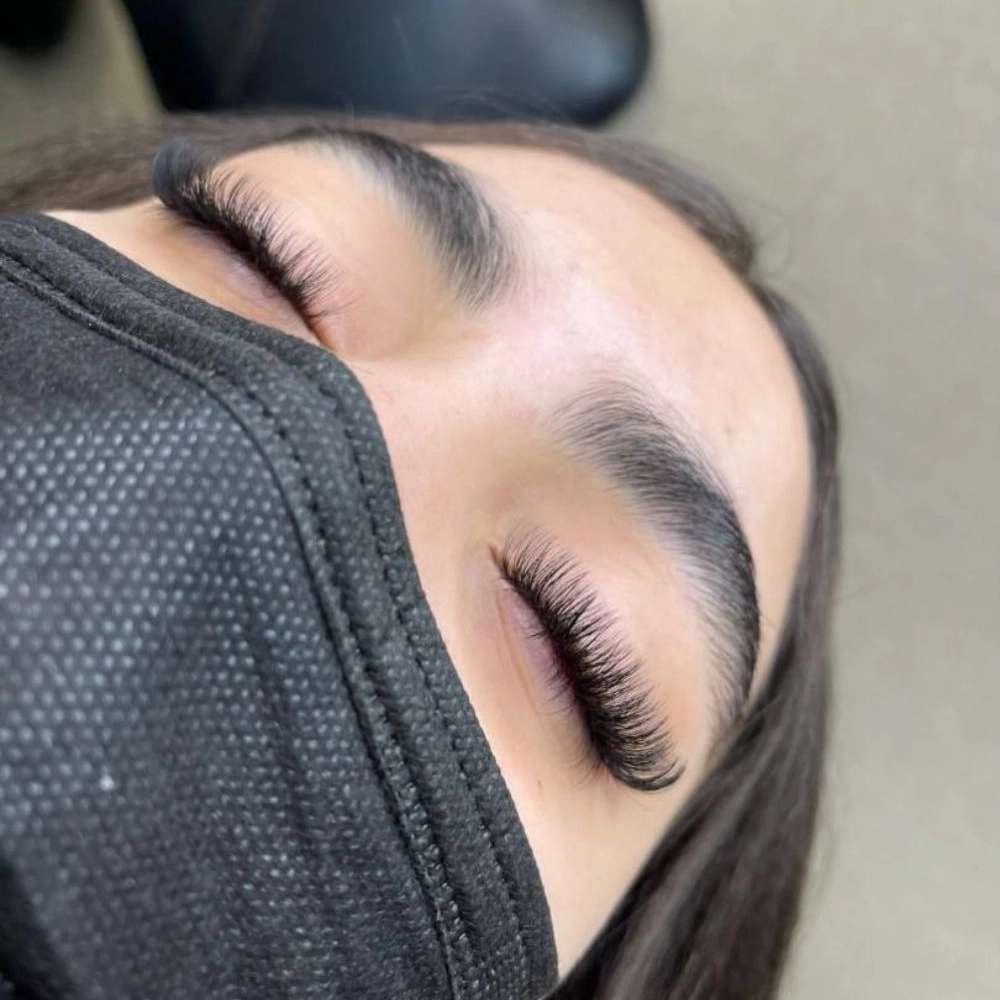 کاشت مژه