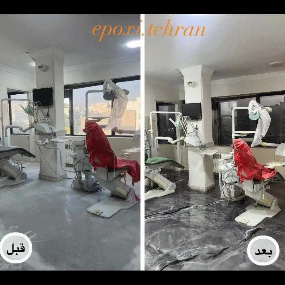 مستر اپوکسی