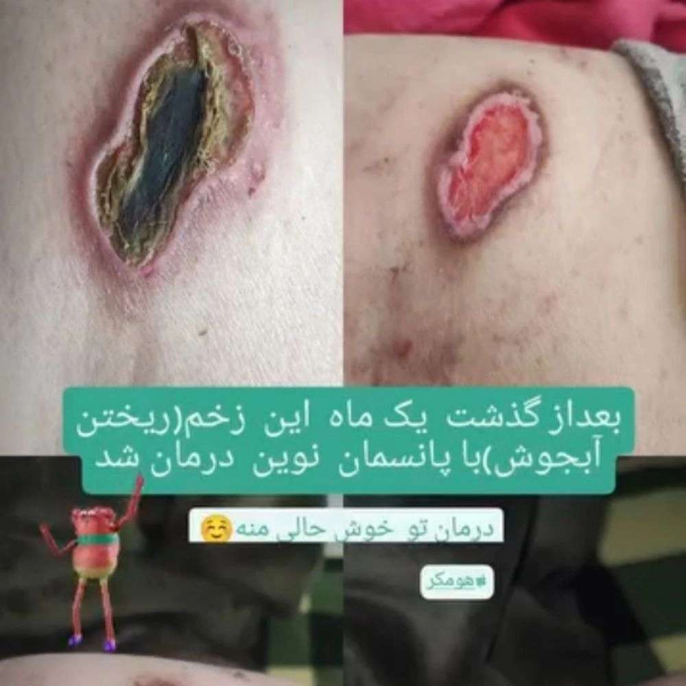 پرستاری در منزل برای سالمندان دیابتی؛ راهکارهای مراقبتی نوین