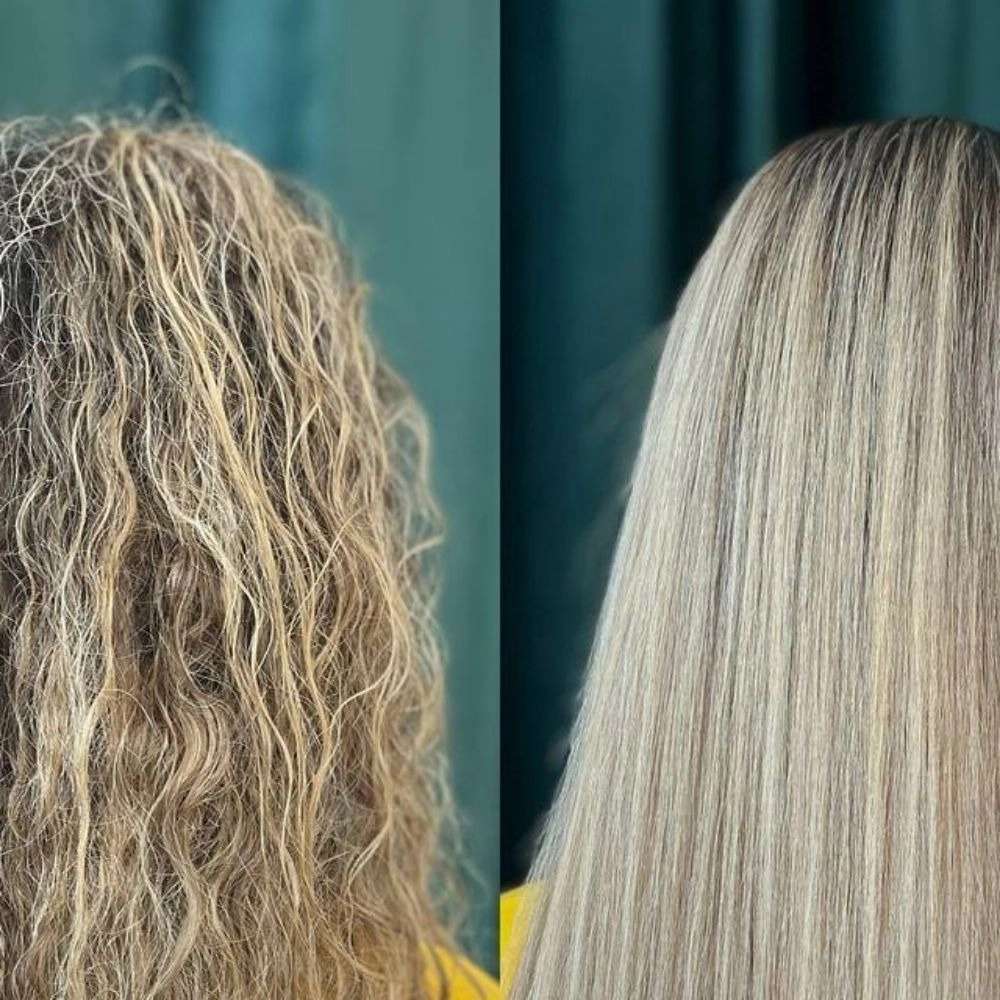 کوکتل تراپی مو چیست و چگونه انجام می شود؟