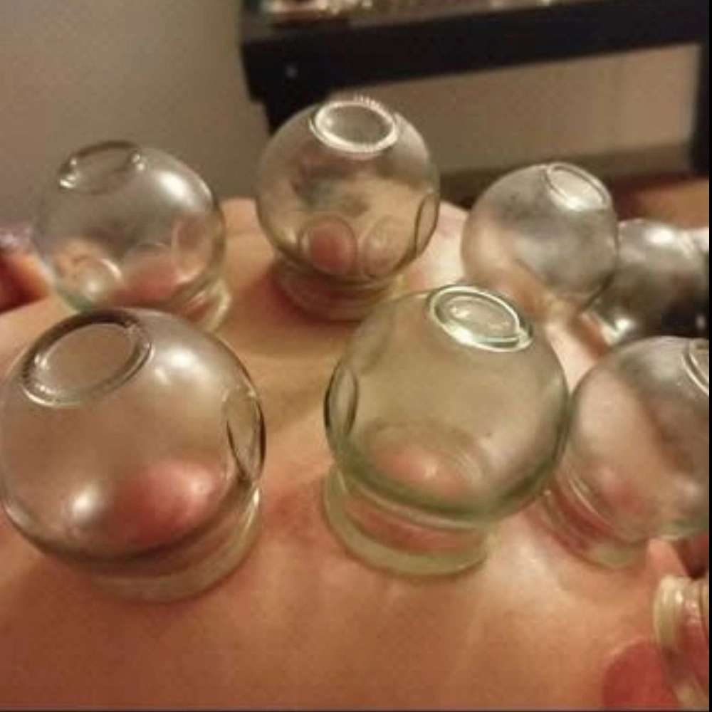 بادکش گرم