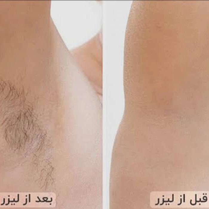 مرکز تخصصی لیزر الکس شاتی