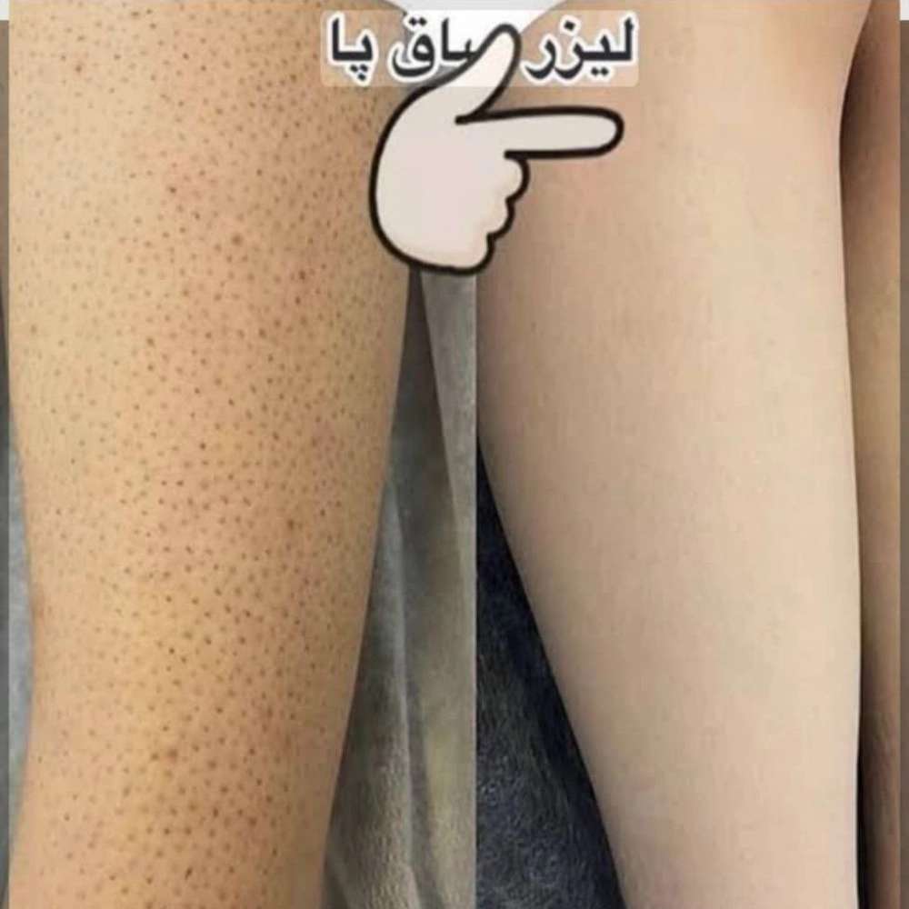 کلینیک لیزر ویژه بانوان