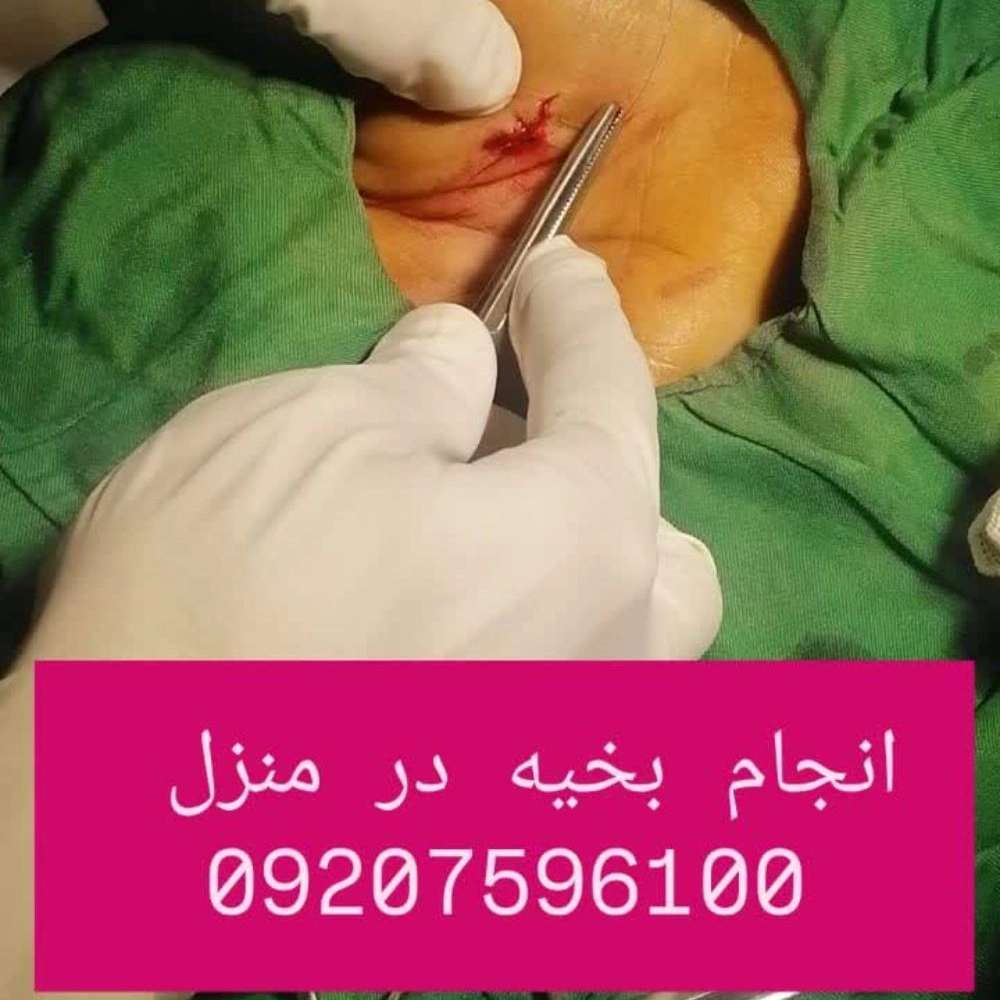 مستر تزریق