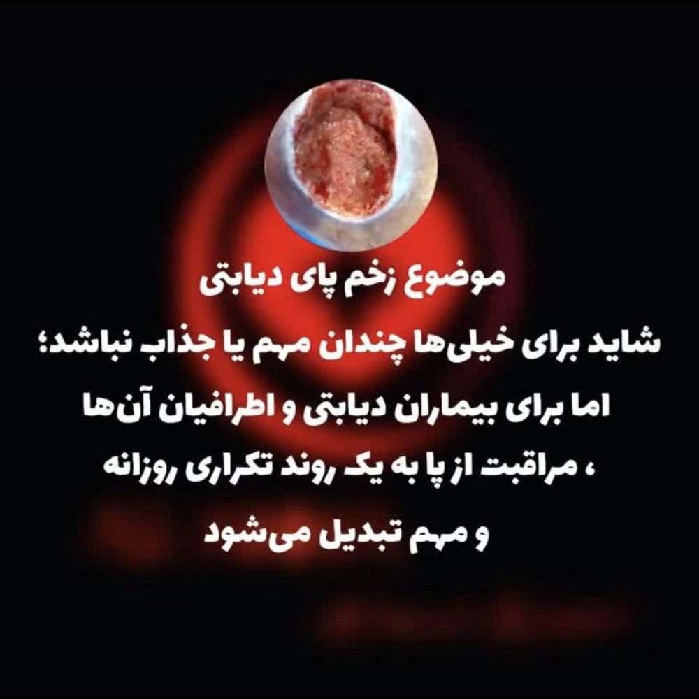 مراقبت پای دیابتی