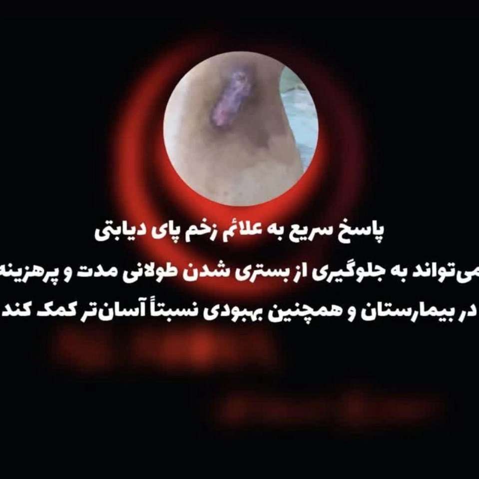 ترمیم زخم دیابت