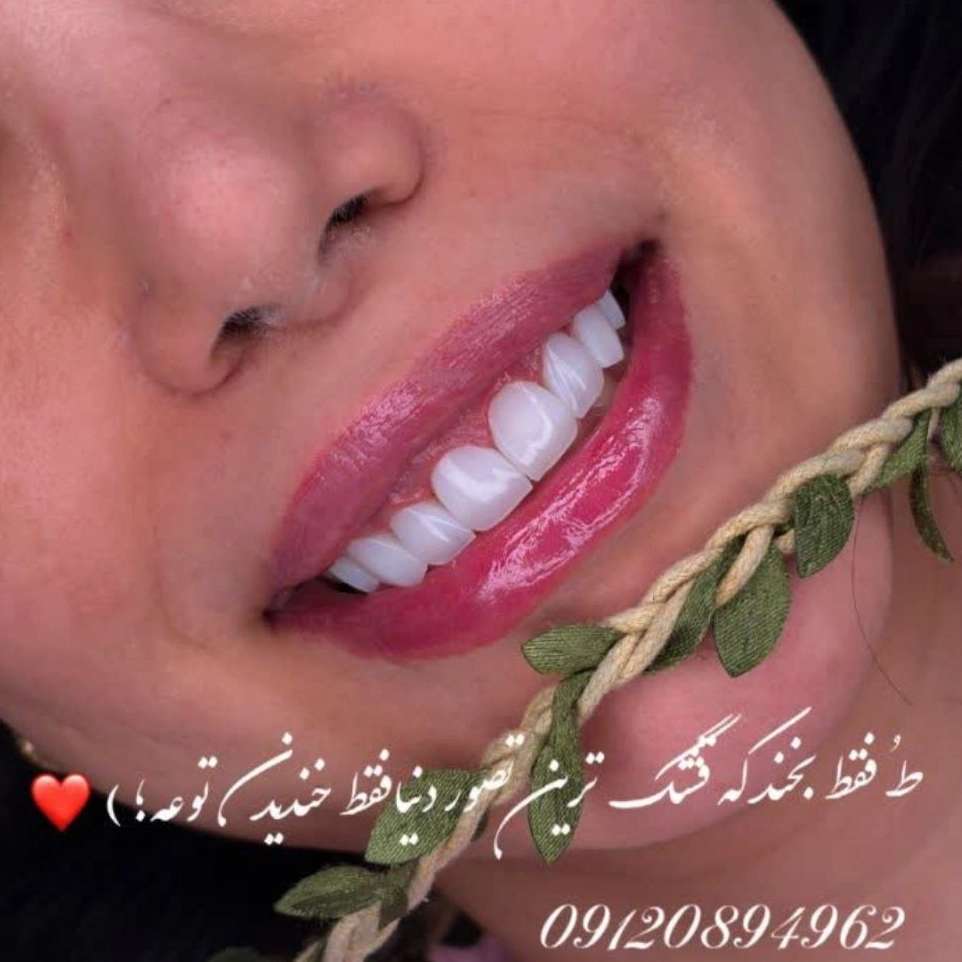 خدمات دندانپزشکی در تهران