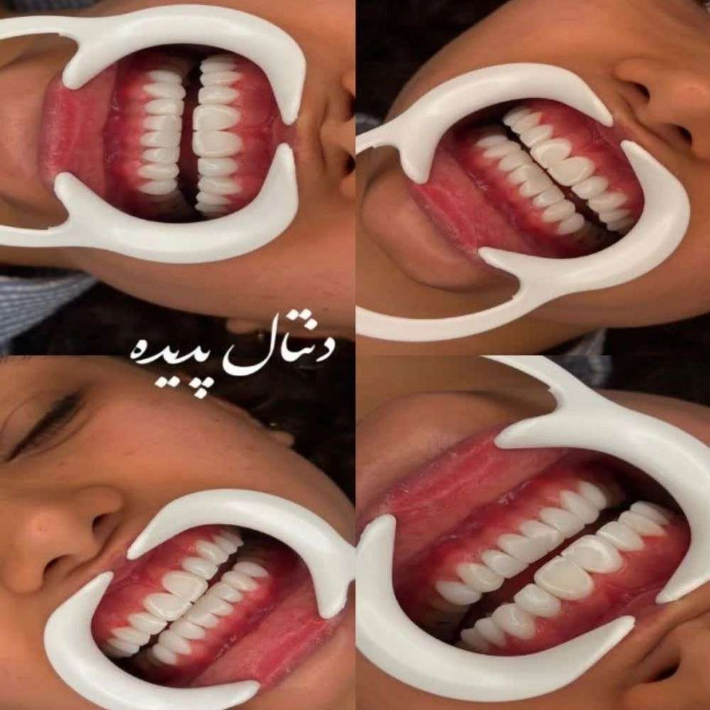 خدمات دندانپزشکی در تهران