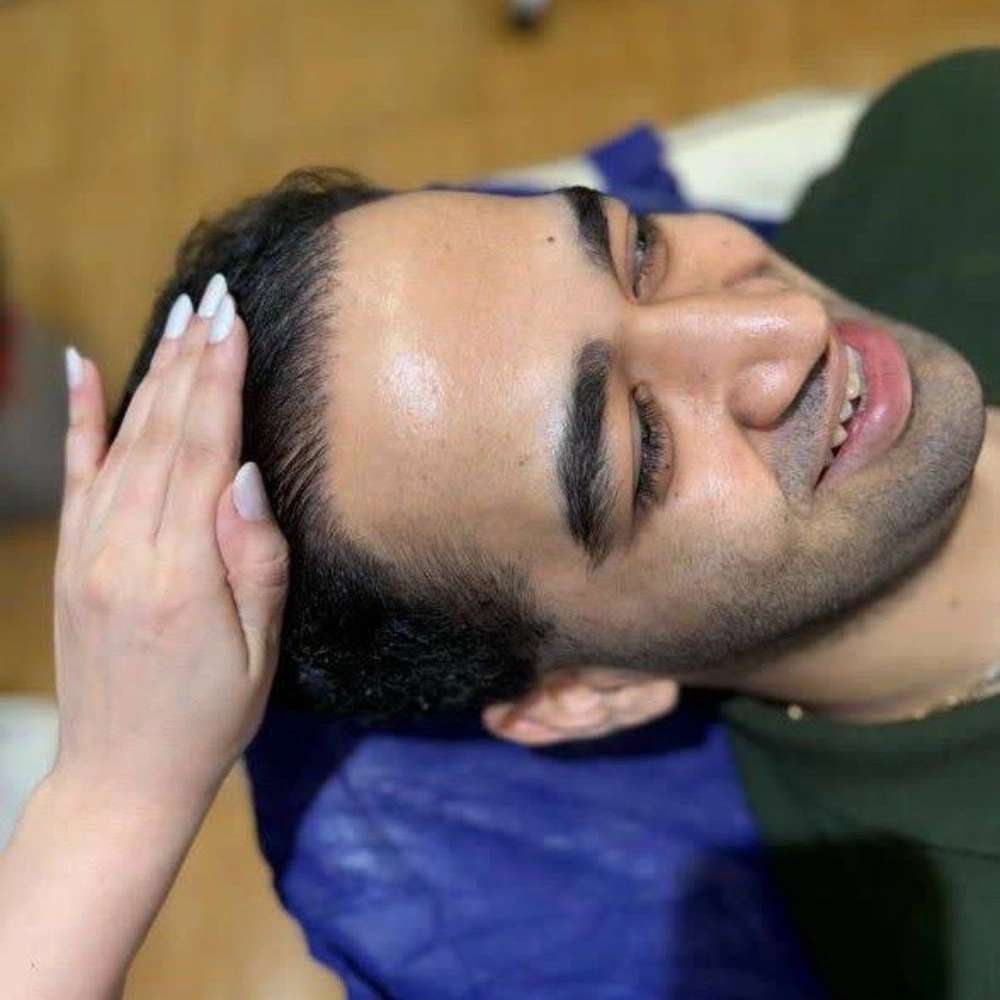 کاشت مو میکروگرافت