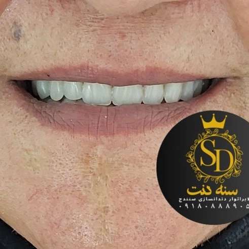 1710547621500.webp