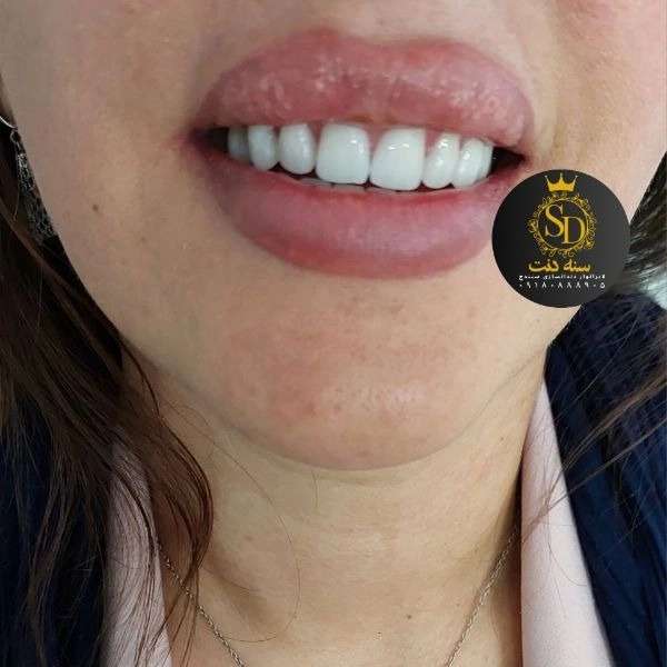 1710548116675.webp