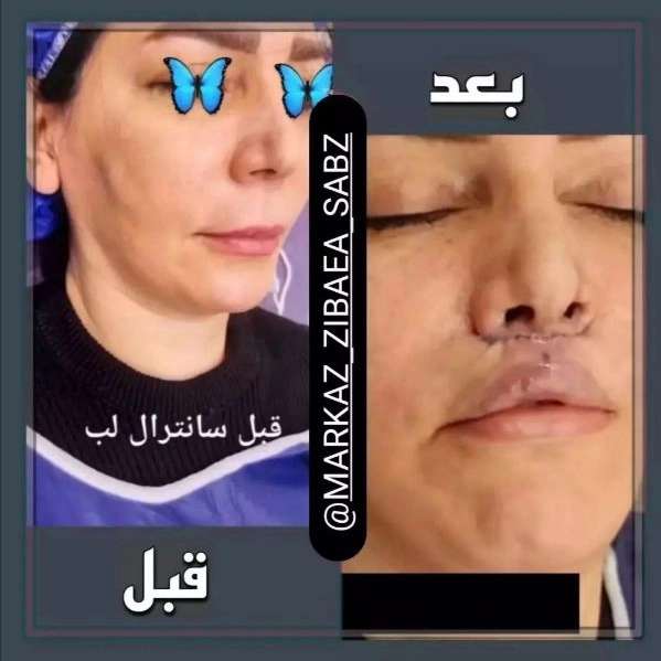 1710577552207.webp