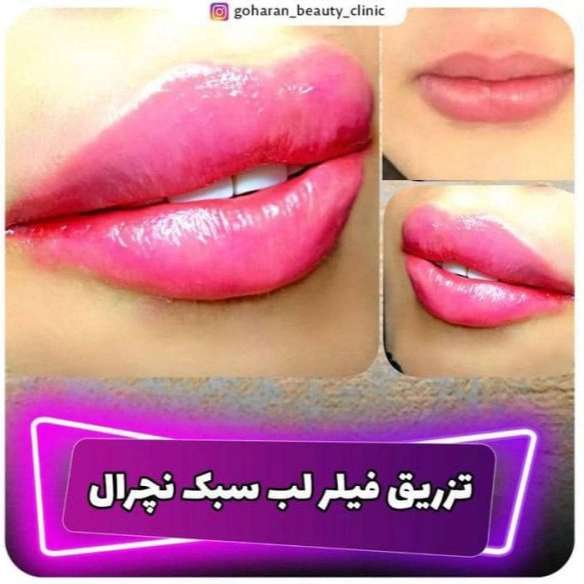 1713865477230.webp