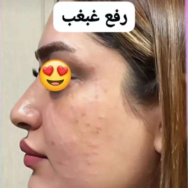 1714632455160.webp