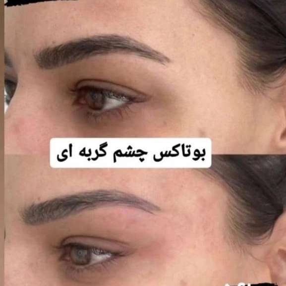 1715081037039.webp