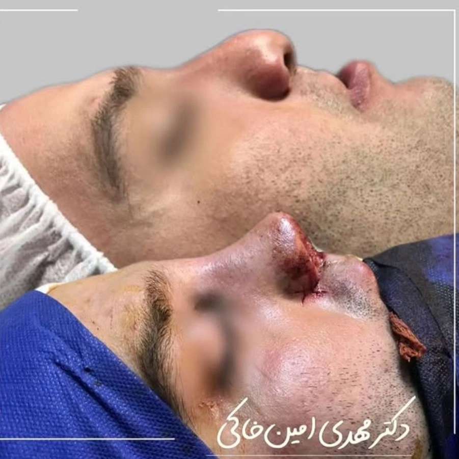 1763194383062.webp