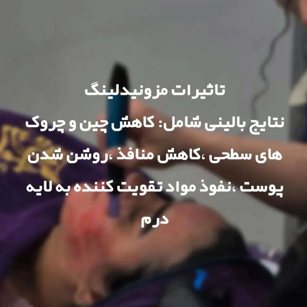 1763376776200.webp