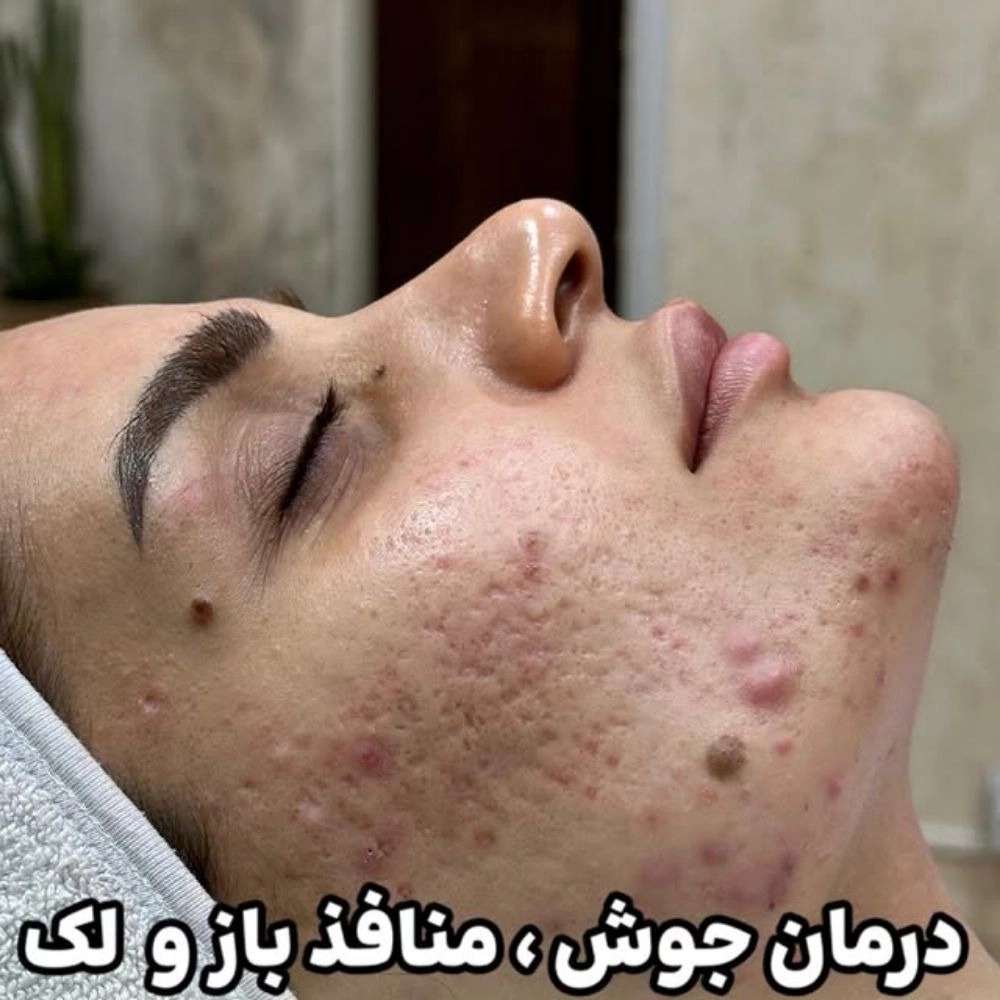 1772257842468.webp