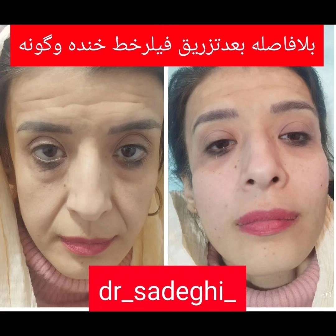 1776755154395.webp
