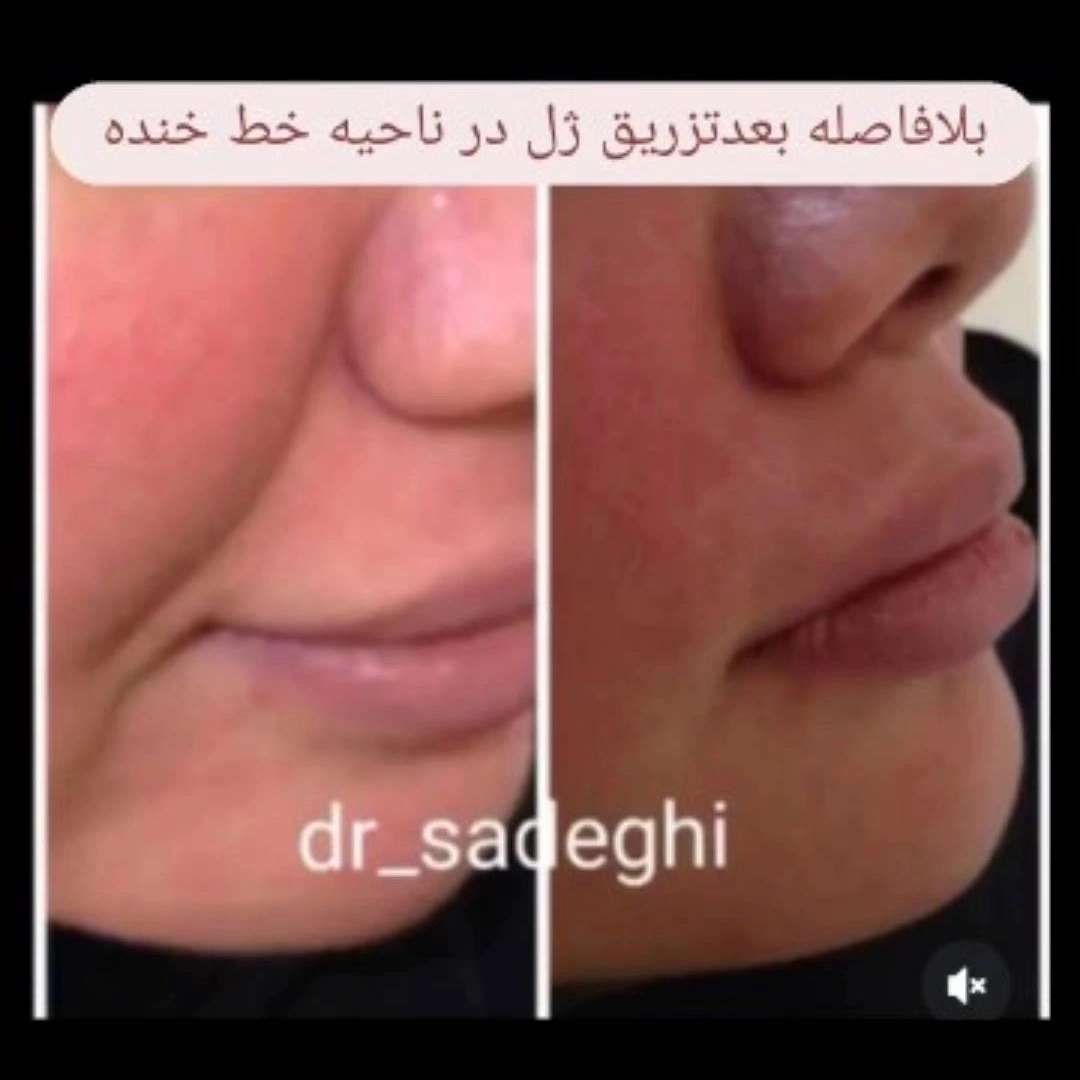 1776755666483.webp