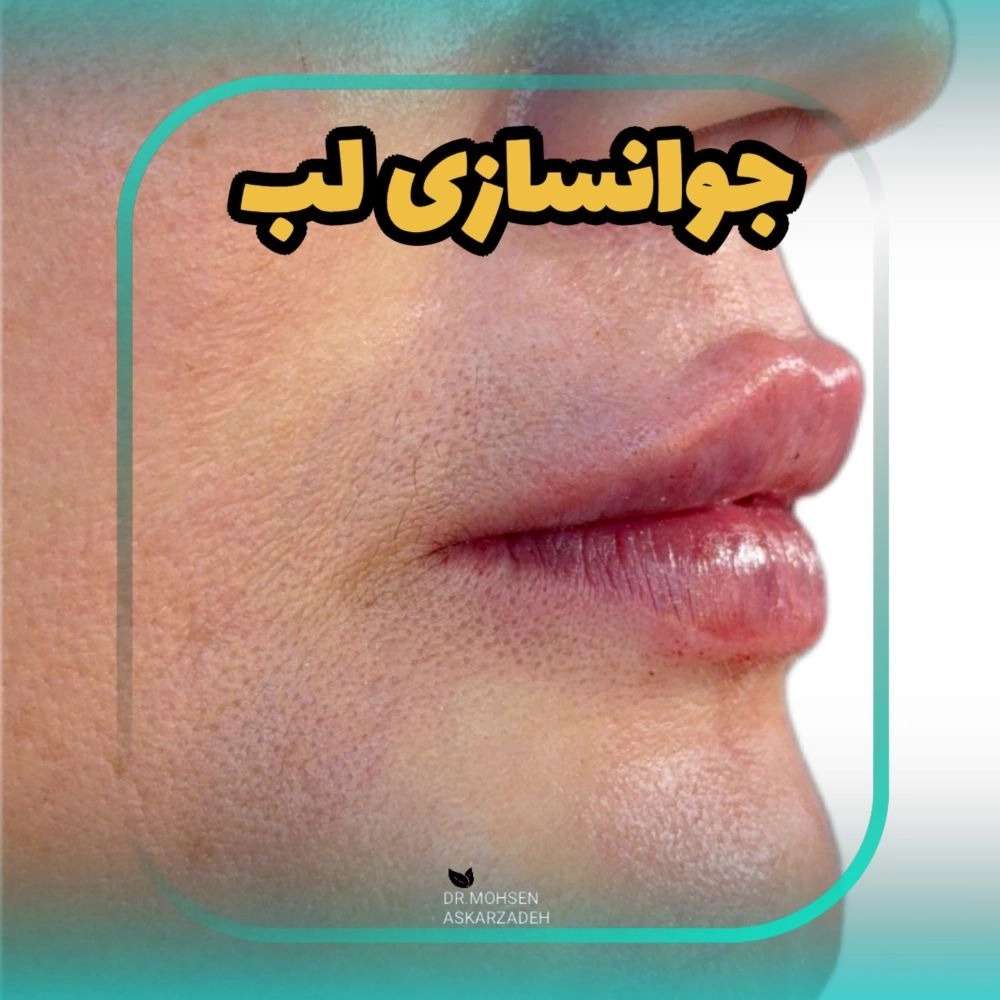 1777897094192.webp