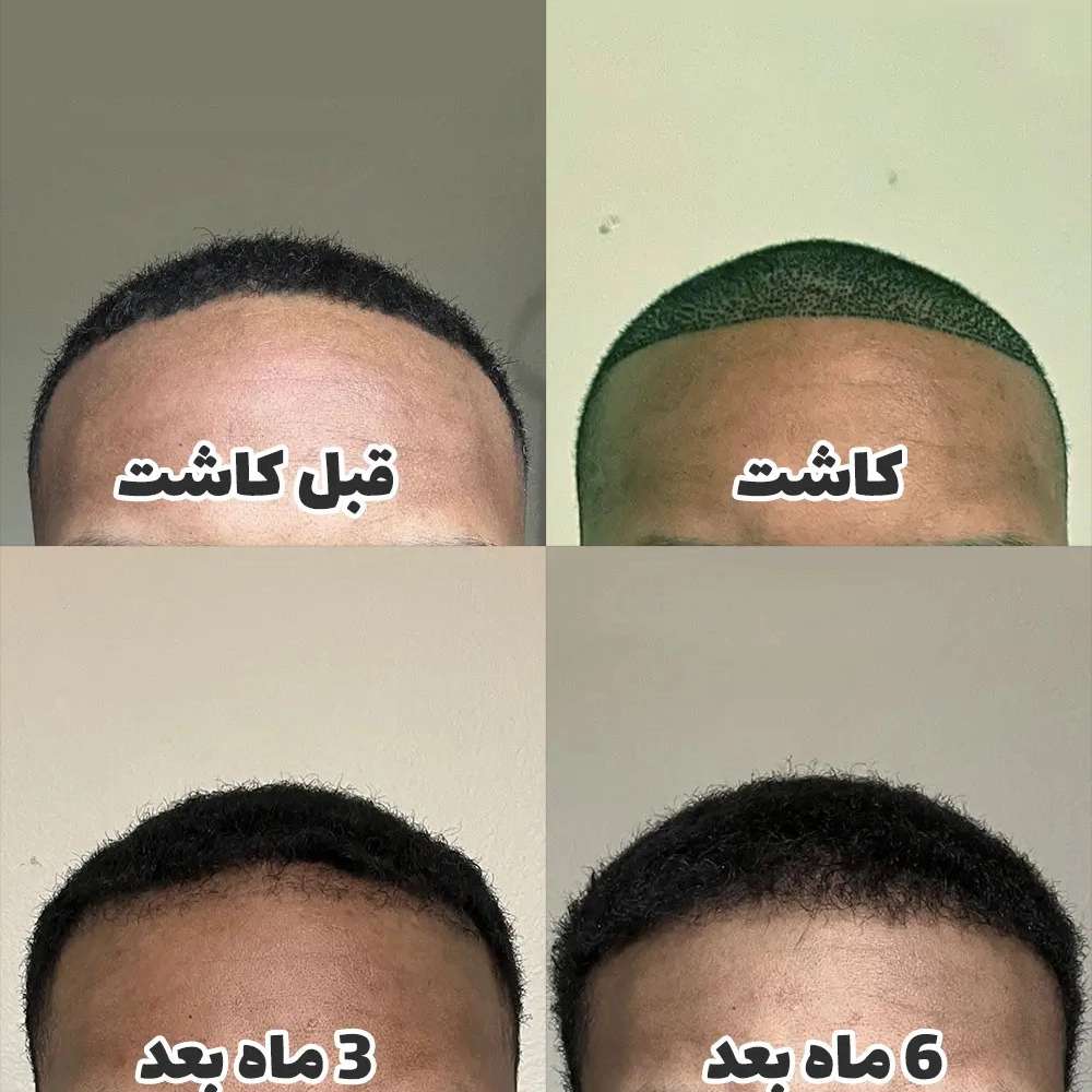 1778313595280.webp