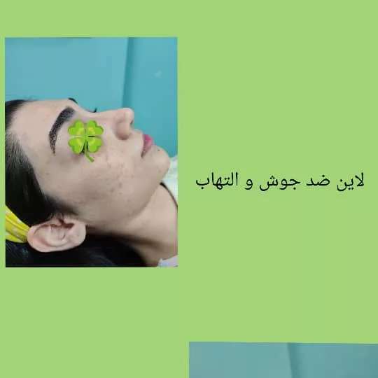 1690176102818.webp