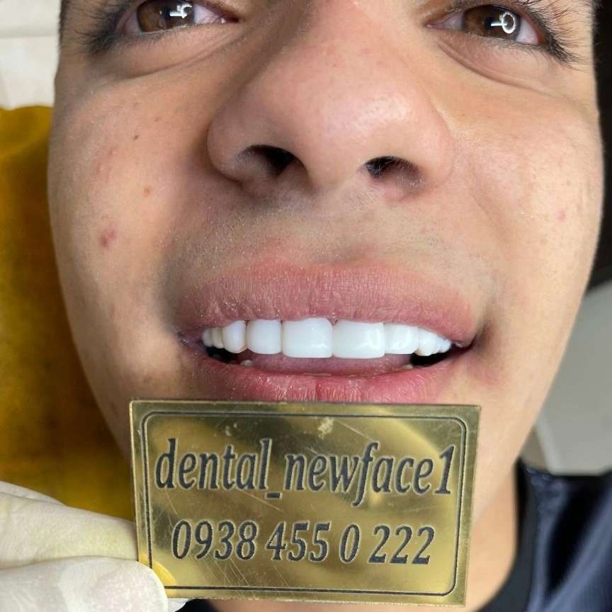 1692164966980.webp