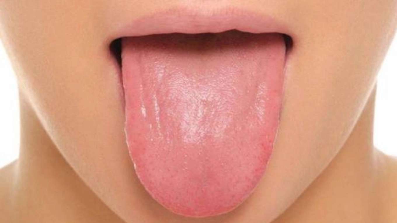 تشخیص بیماری از زبان
