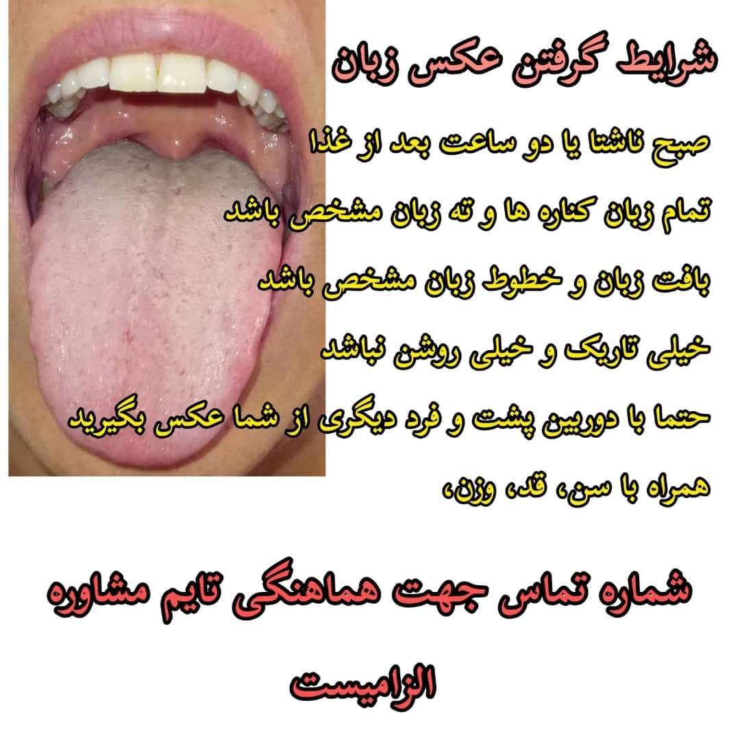 1694320867803.webp