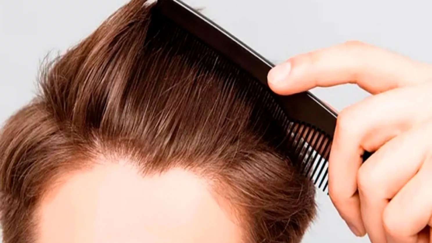 کلینیک تخصصی کاشت مو