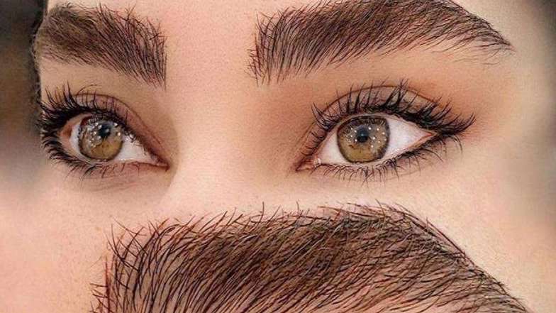 میکروبلیدینگ حسینی