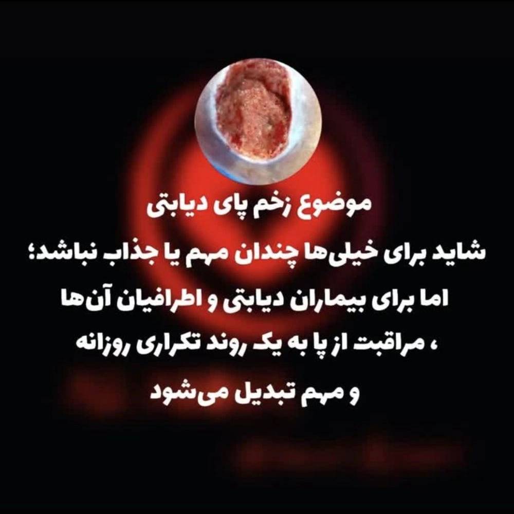 1772004145529.webp