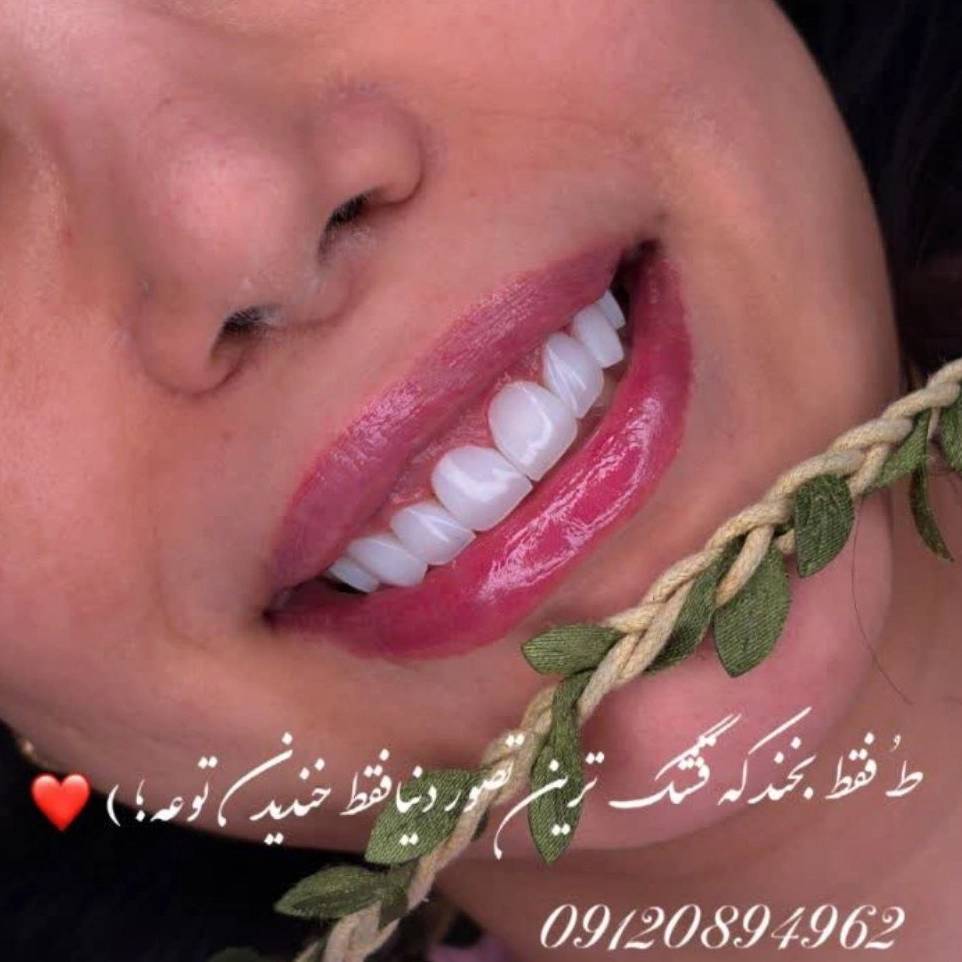 خدمات دندانپزشکی در تهران