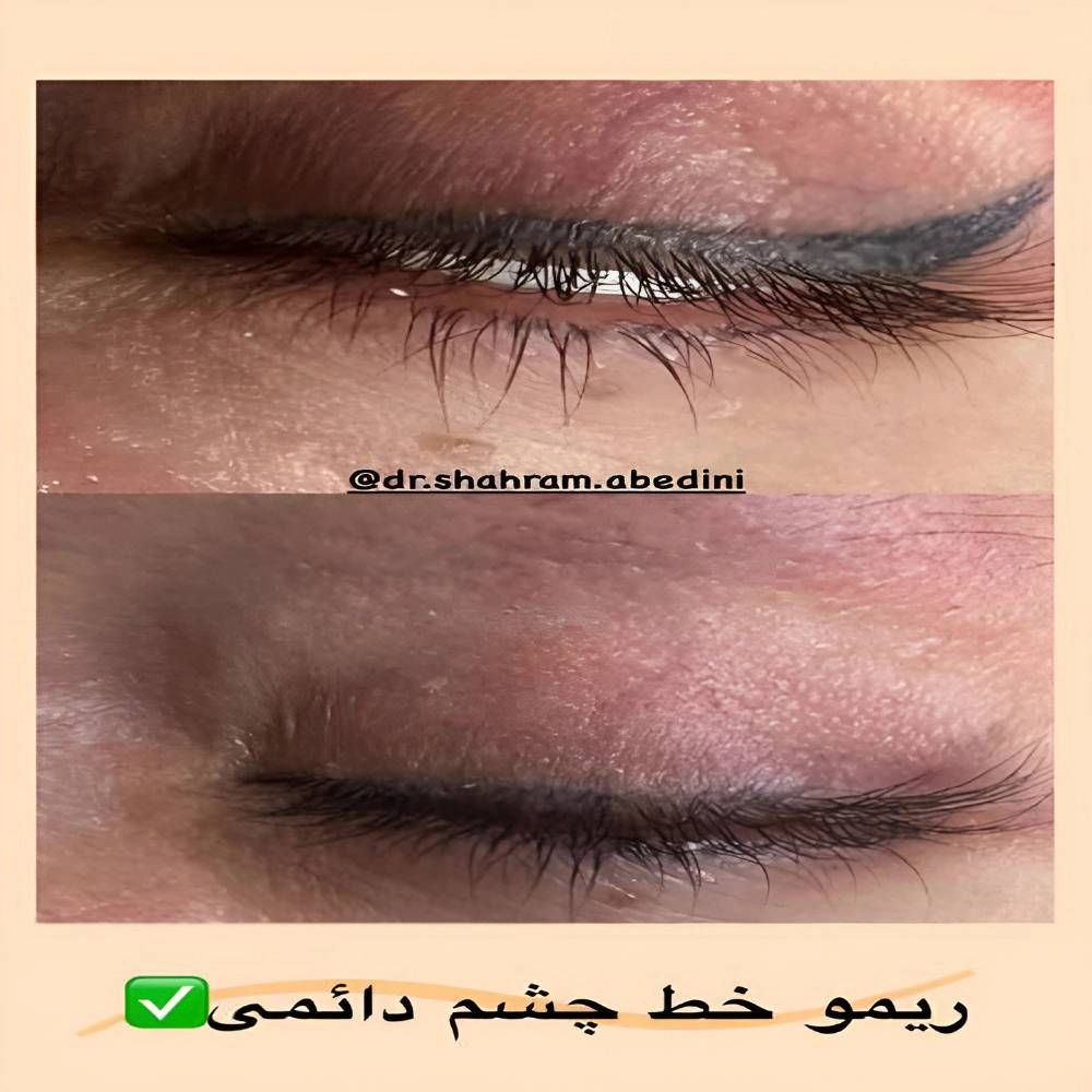 1785138164033.webp