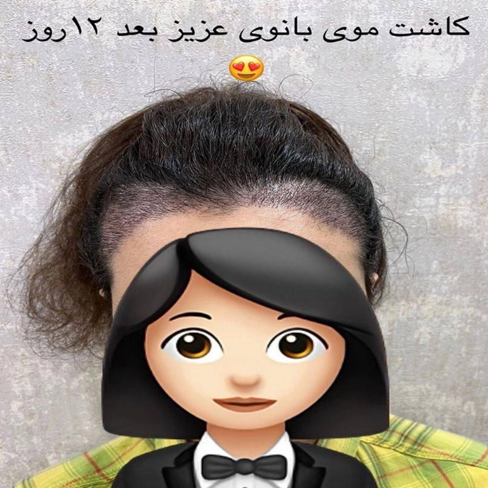 1787218620252.webp