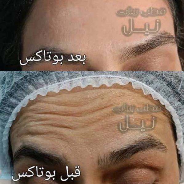 1710144957628.webp