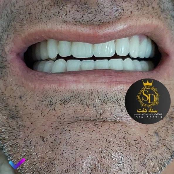 1710546582047.webp