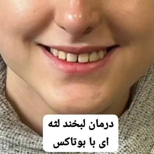 1714632484142.webp