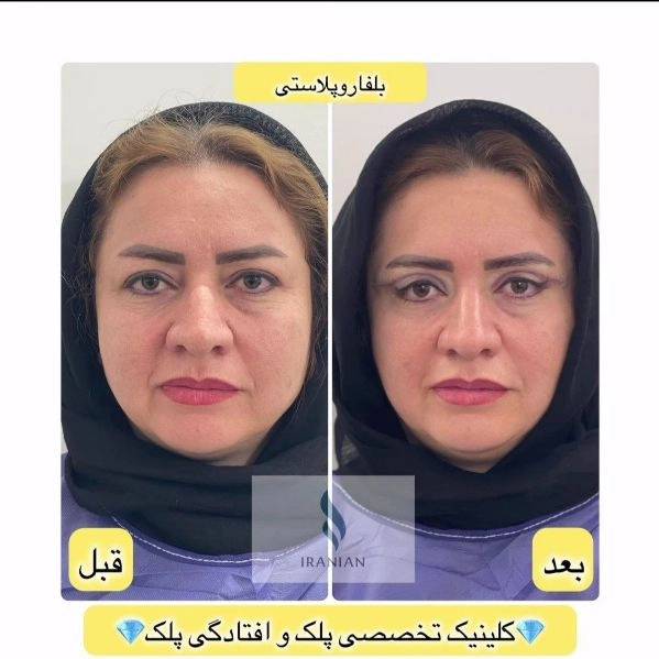 1722336616192.webp
