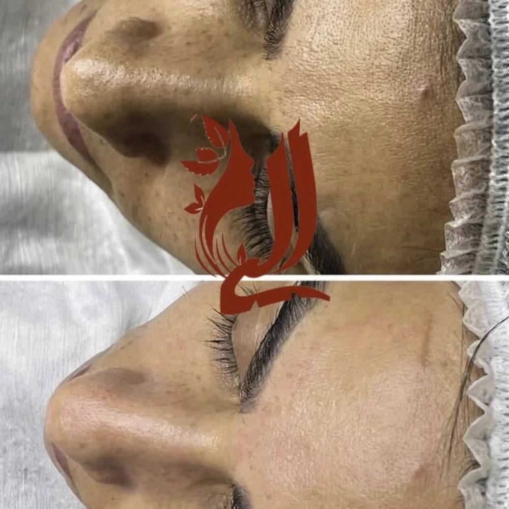 1754218123214.webp