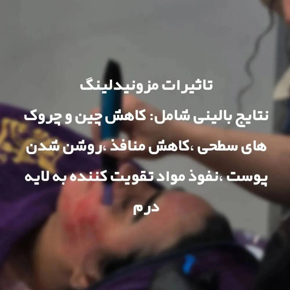 1763376776200.webp